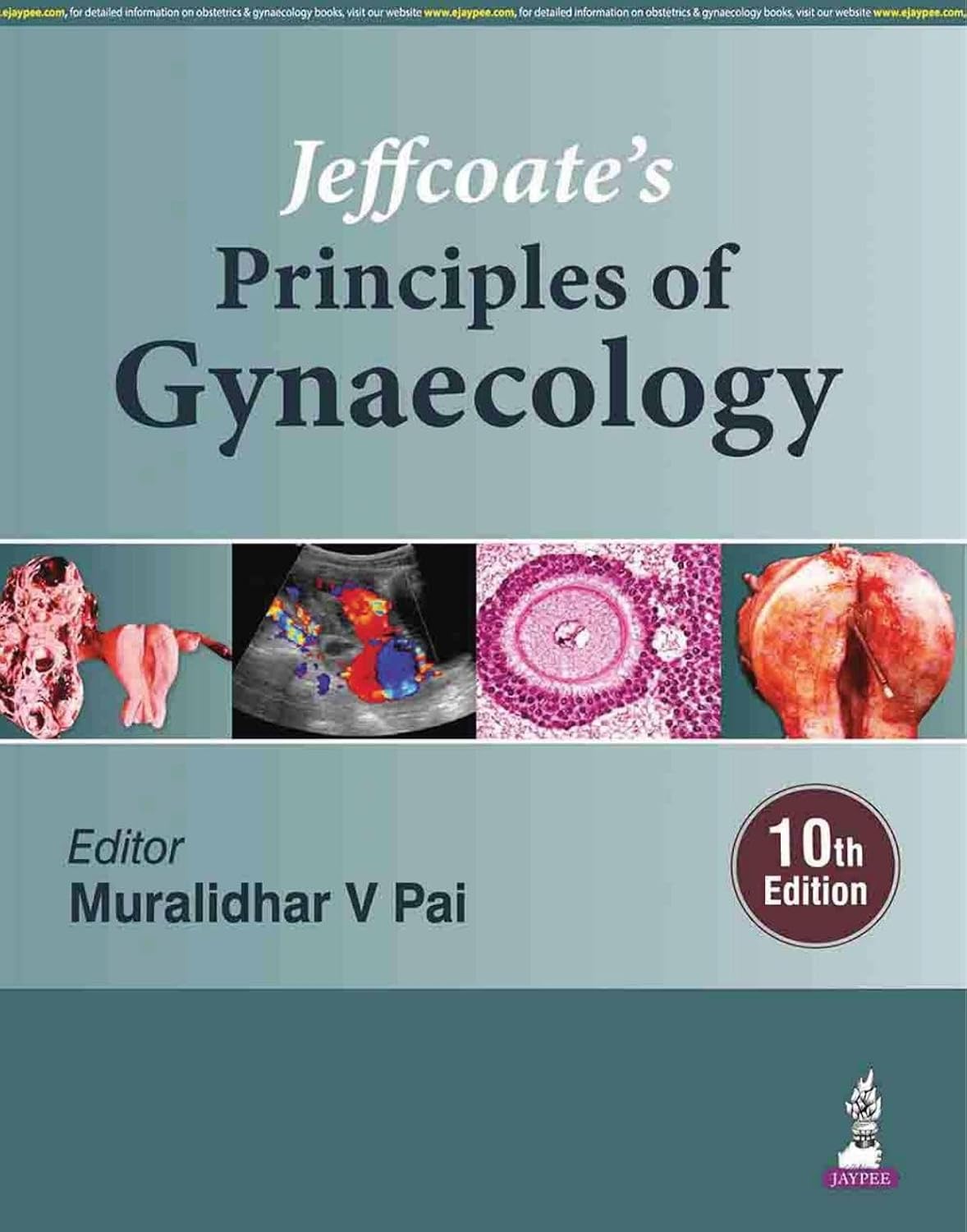 Jeffcoate'S Principles of Gynaecology
