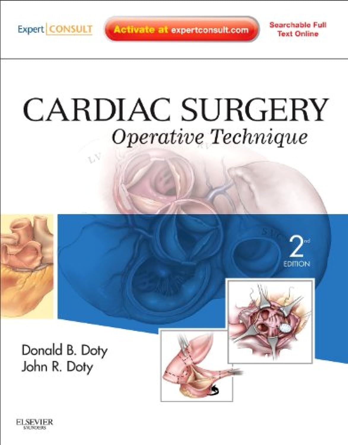 CARDIAC SURGERY OPERATIVE TECHNIQUE 2ED (HB 2012)