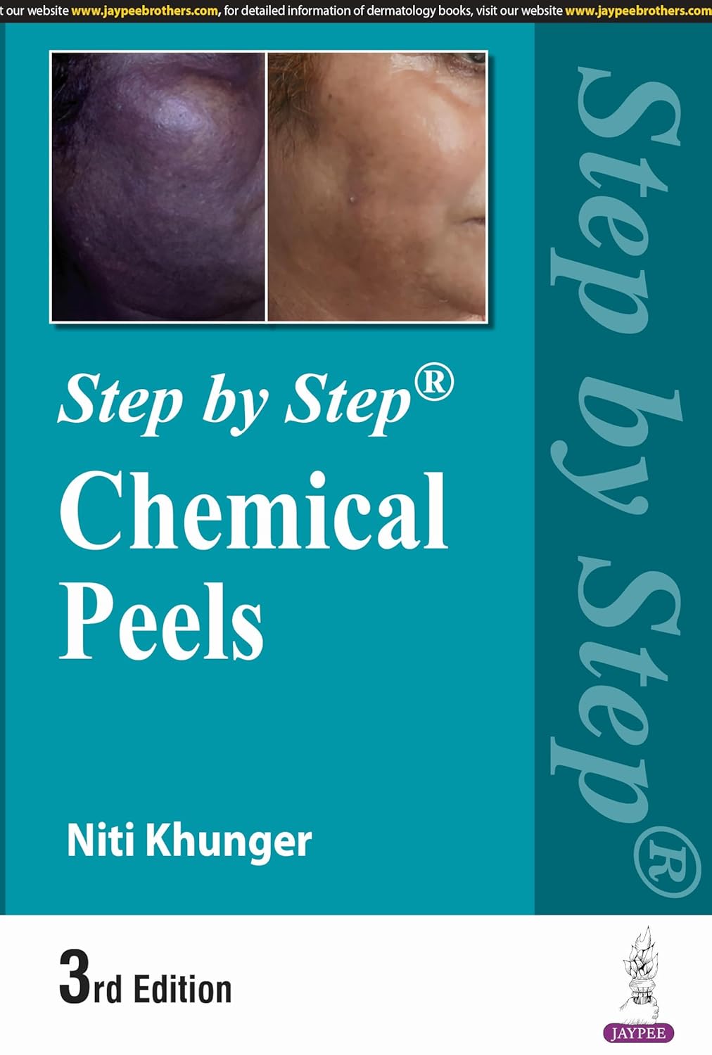 Step by Step Chemical Peels