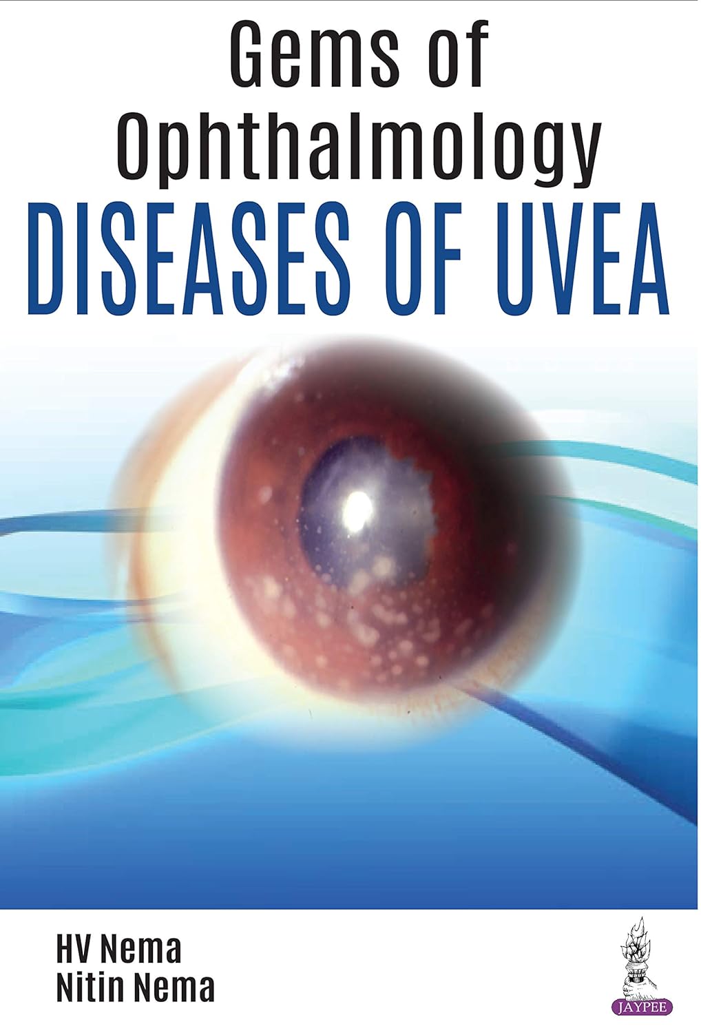 Gems of Ophthalmology: Diseases of Uvea