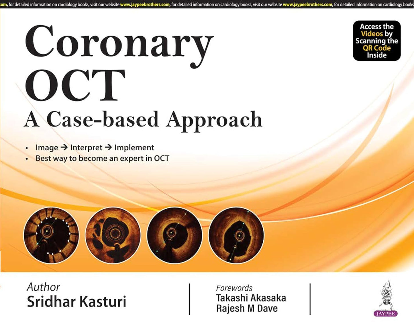 Coronary Oct a Case-Based Approach