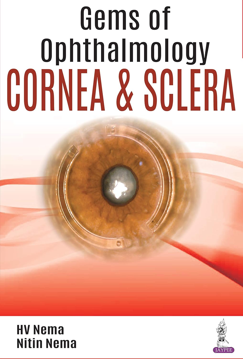 Gems of Ophthalmology Cornea & Sclera
