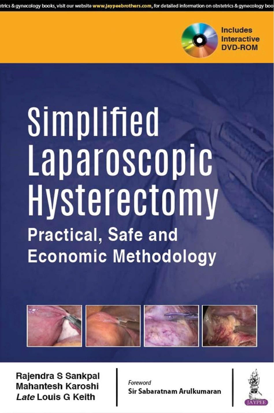 Simplified Laparoscopic Hysterectomy Practical, Safe and Economic Methodology with Dvd-Rom