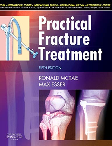 Practical Fracture Treatment, 5e