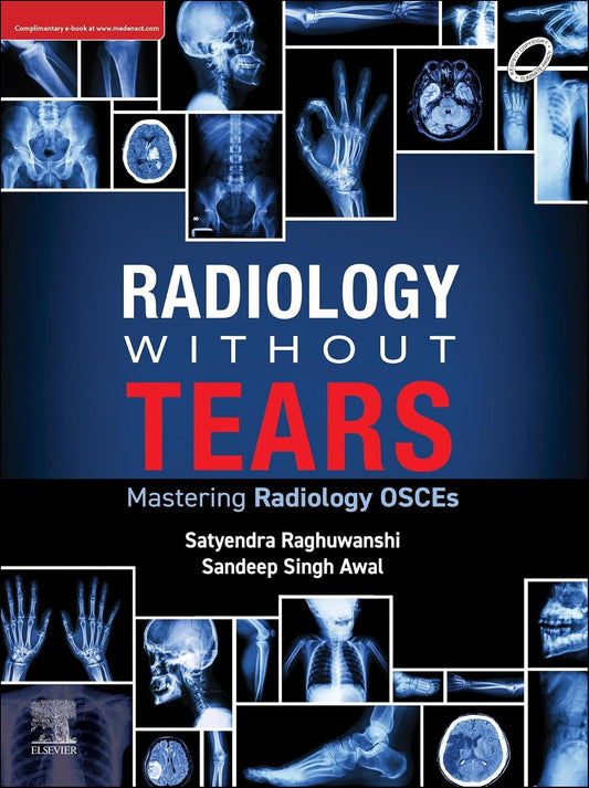 Radiology Without Tears: Mastering Radiology OSCEs