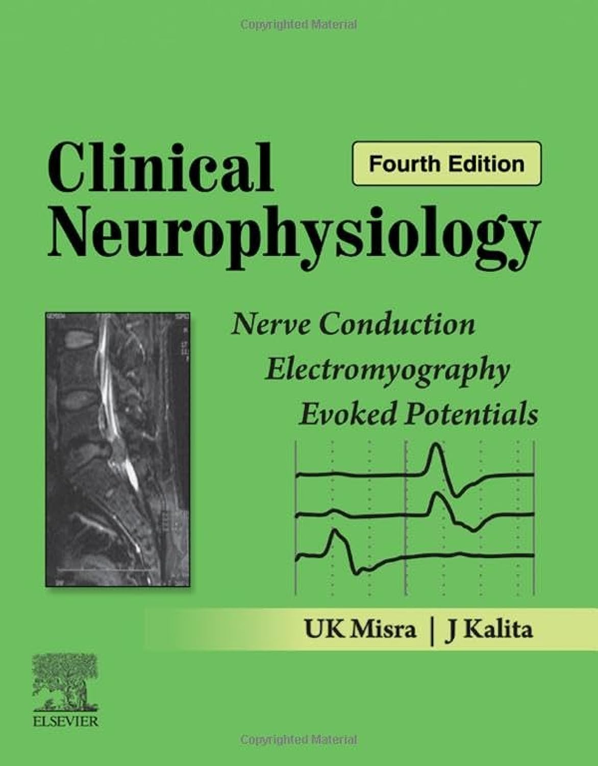 Clinical Neurophysiology: Nerve Conduction,Electromyography,Evoked Potentials,4e