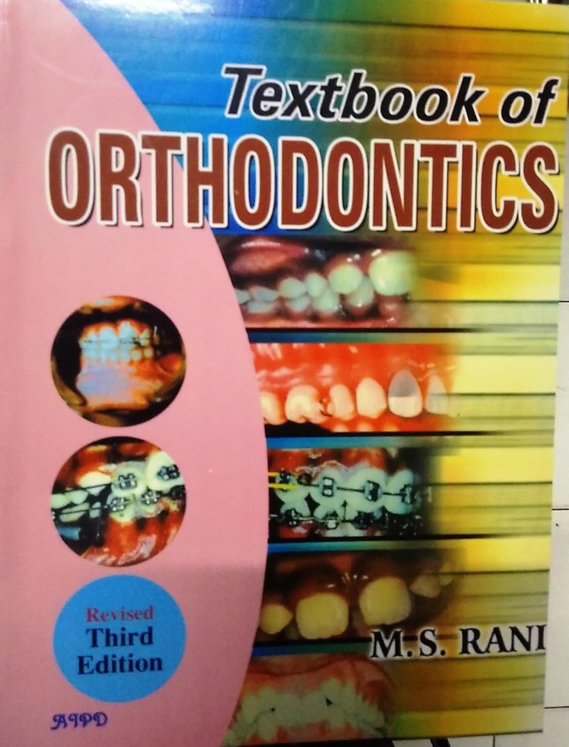 TEXT BOOK OF ORTHODONTICS