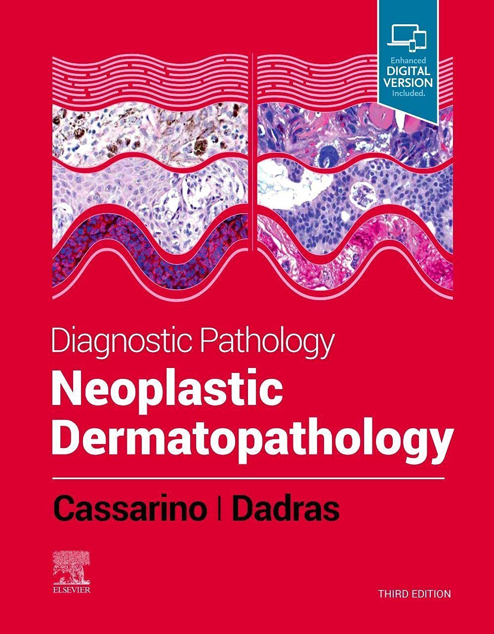 Diagnostic Pathology: Neoplastic Dermatopathology,3e