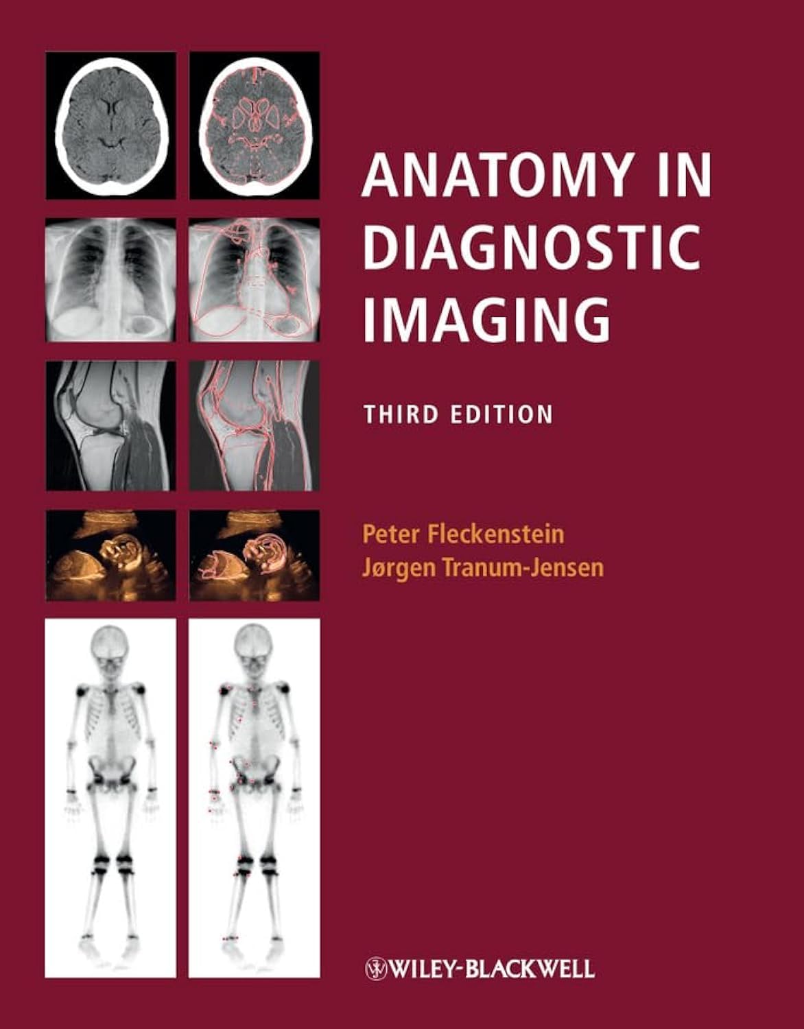Anatomy in Diagnostic Imaging, 3E