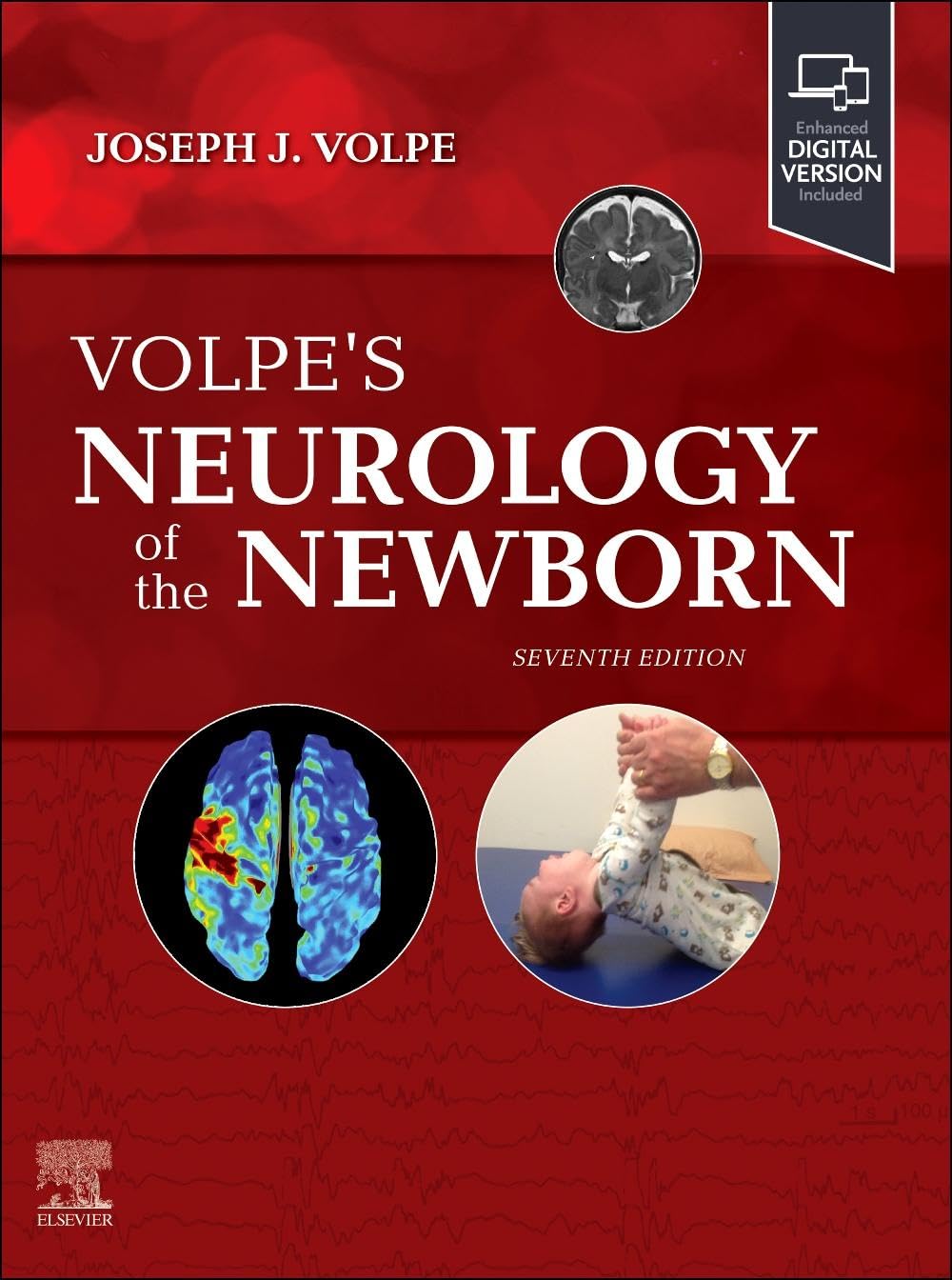 Volpe's Neurology of the Newborn, 7th Edition: 2025