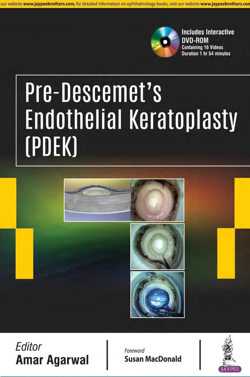 Pre-Descemet'S Endothelial Keratoplasty(Pdek)