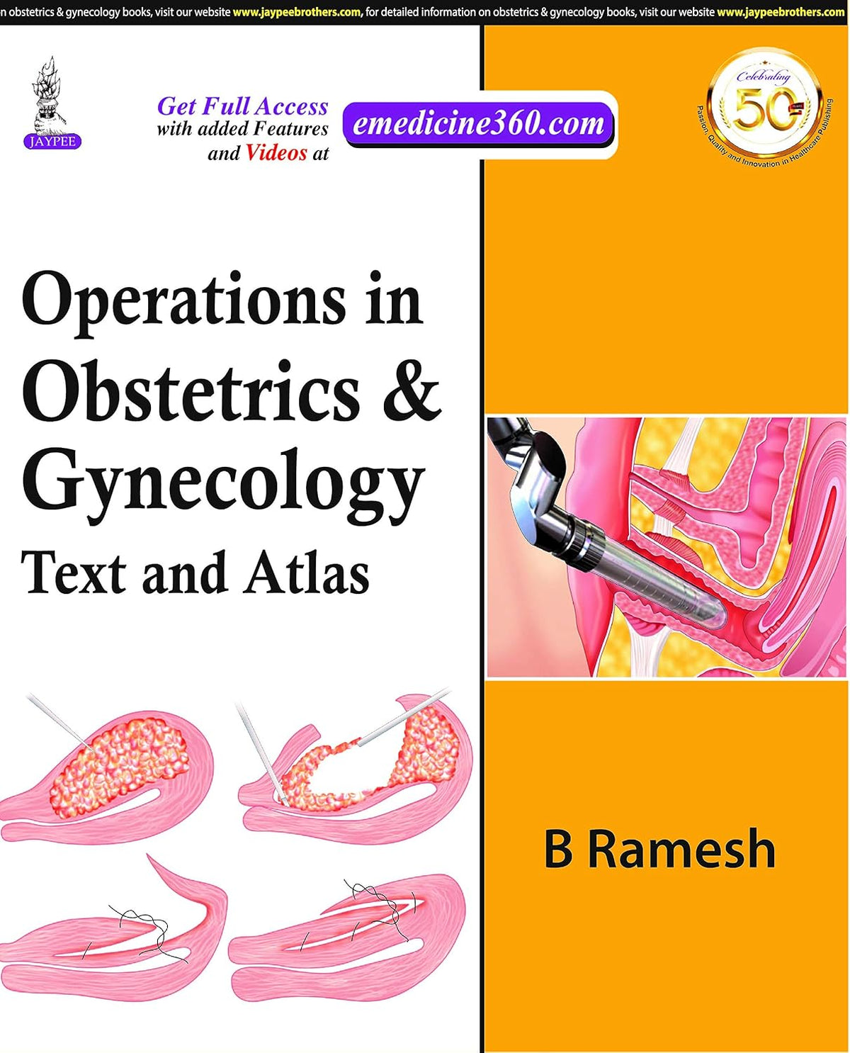 Operations in Obstetrics & Gynecology: Text and Atlas