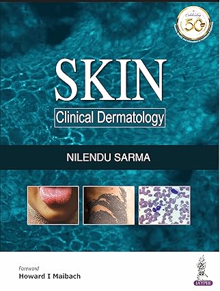 Skin Clinical Dermatology