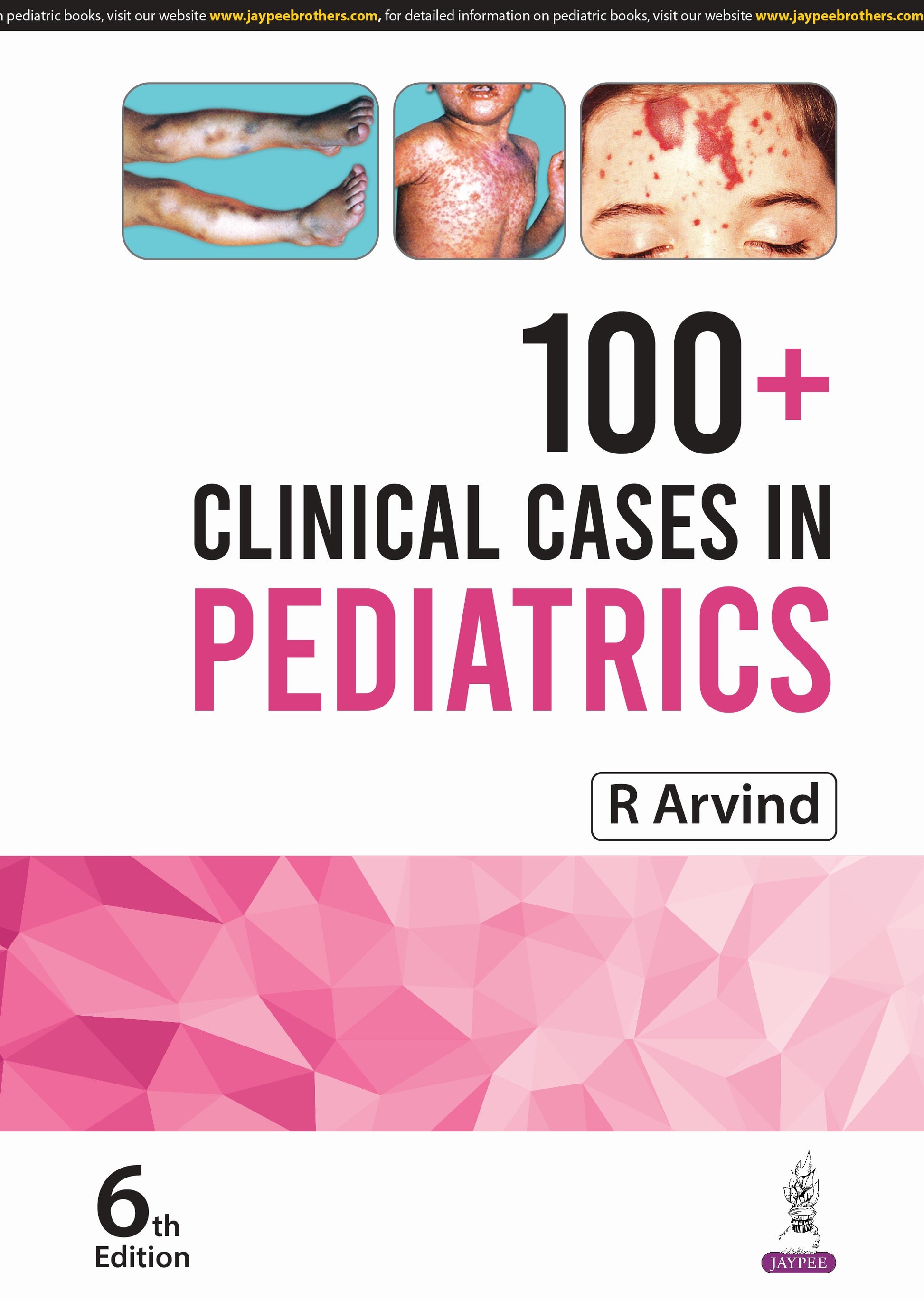 100+ Clinical Cases In Pediatrics 6th/2025
