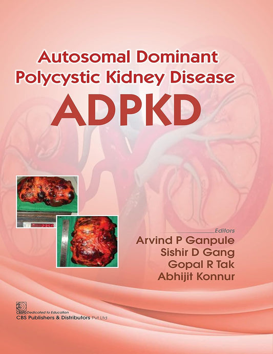 Autosomal Dominant Polycystic Kidney Disease Adpkd (Flexibond 2022)