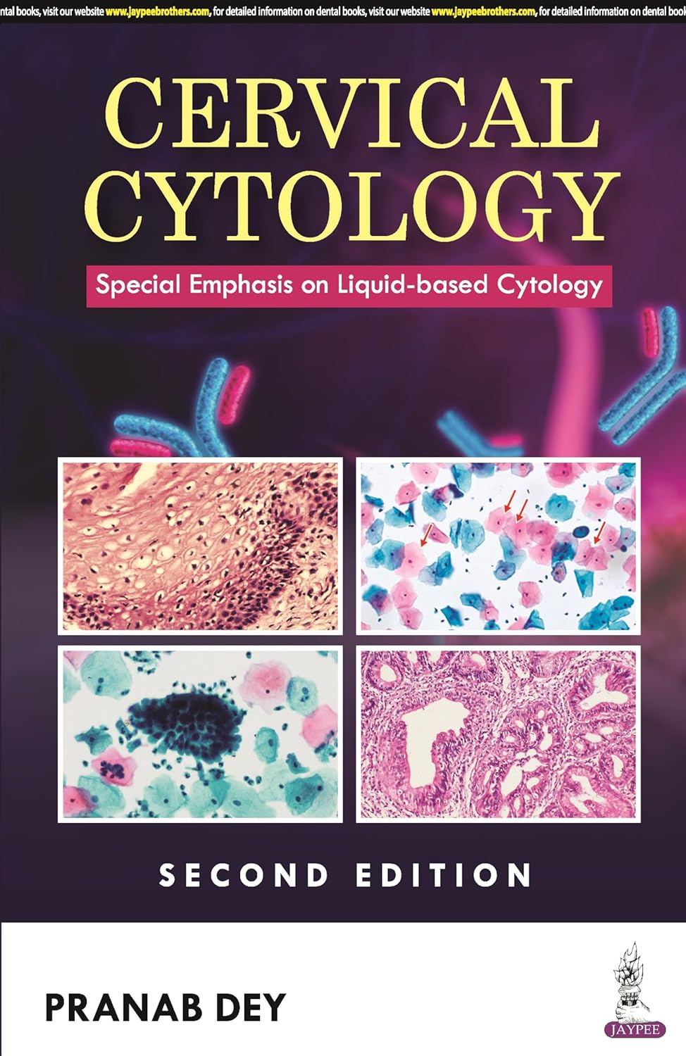 Cervical Cytology: Special Emphasis on Liquid-Based Cytology