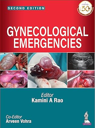 Gynecological Emergencies