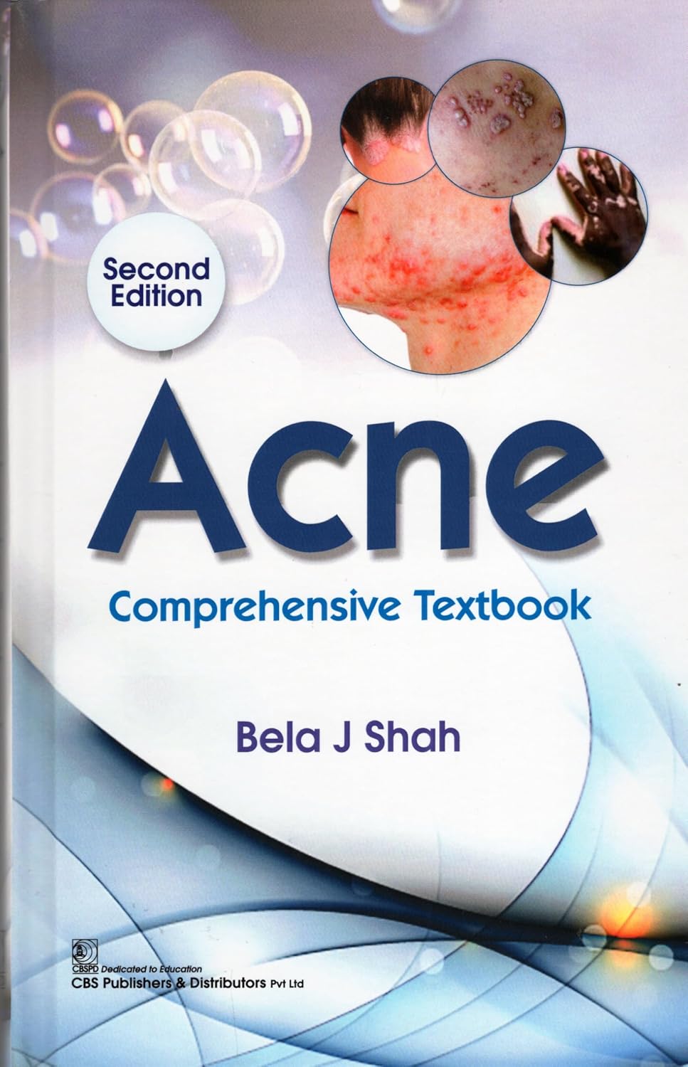 Acne Comprehensive Textbook 2Ed (HB)