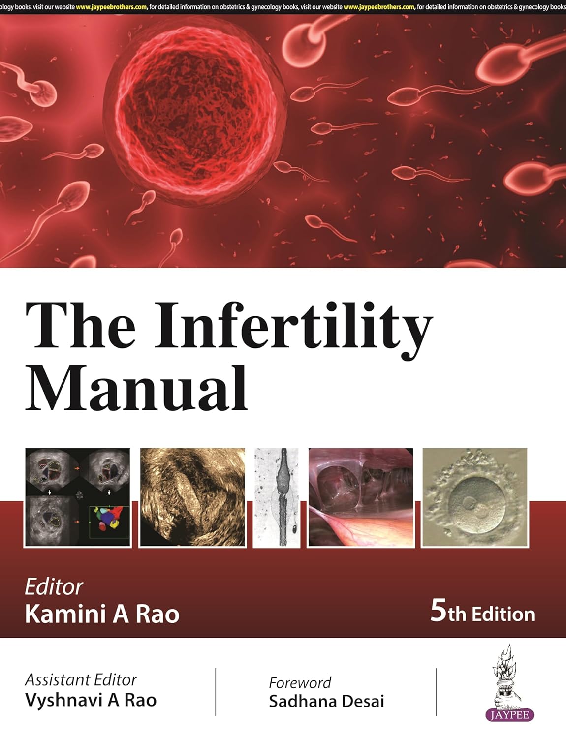 The Infertility Manual