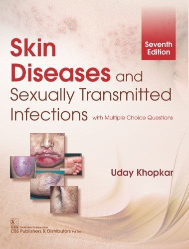 Skin Diseases And Sexually Transmitted Infections (PB)