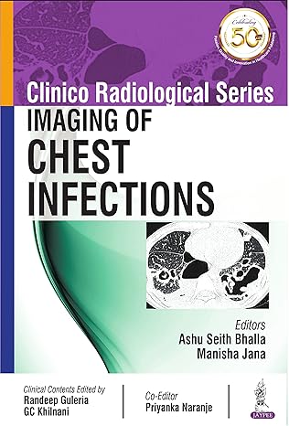 Clinico Radiological Series Imaging of Chest Infections