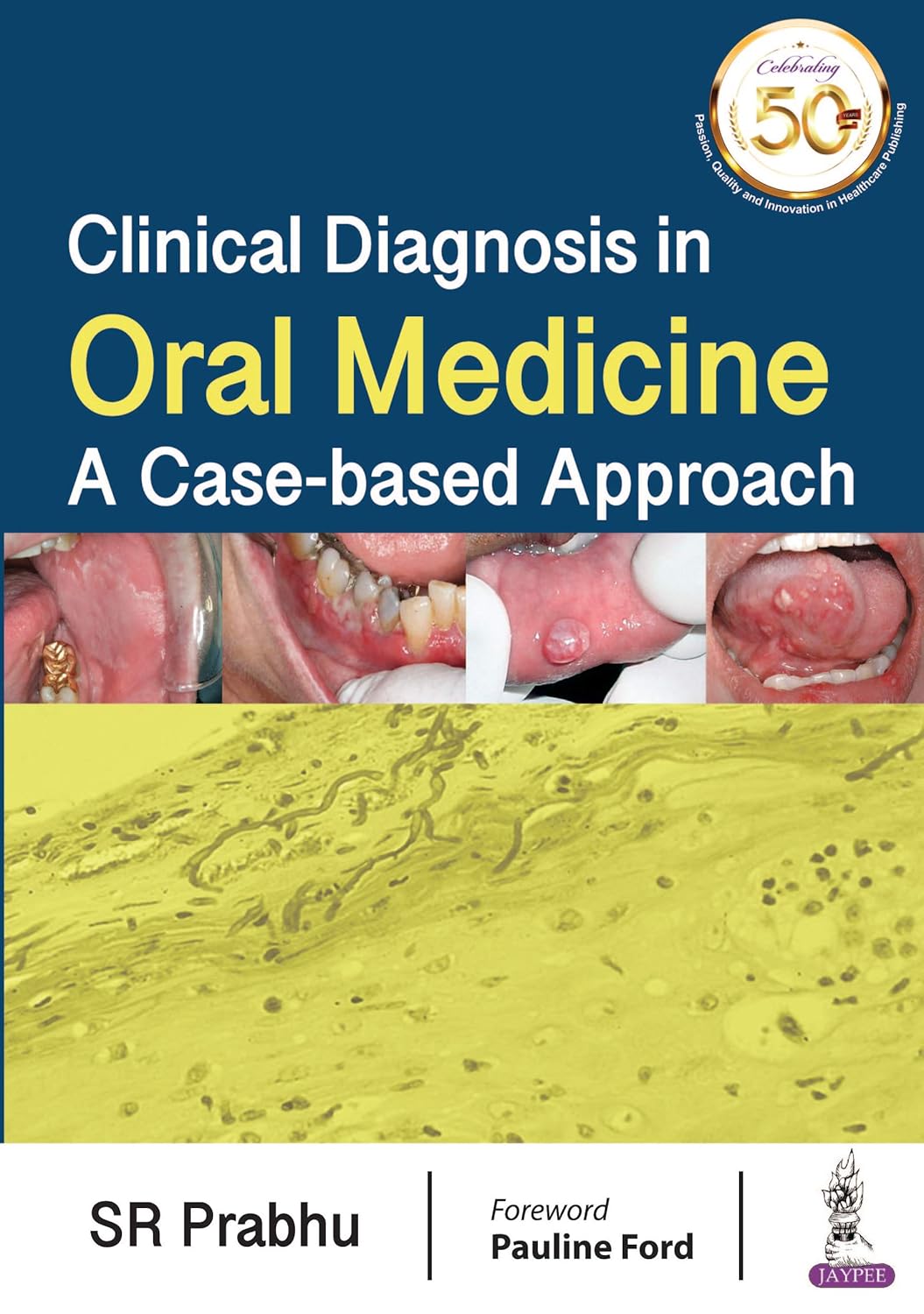 Clinical Diagnosis in Oral Medicine: a Case-Based Approach
