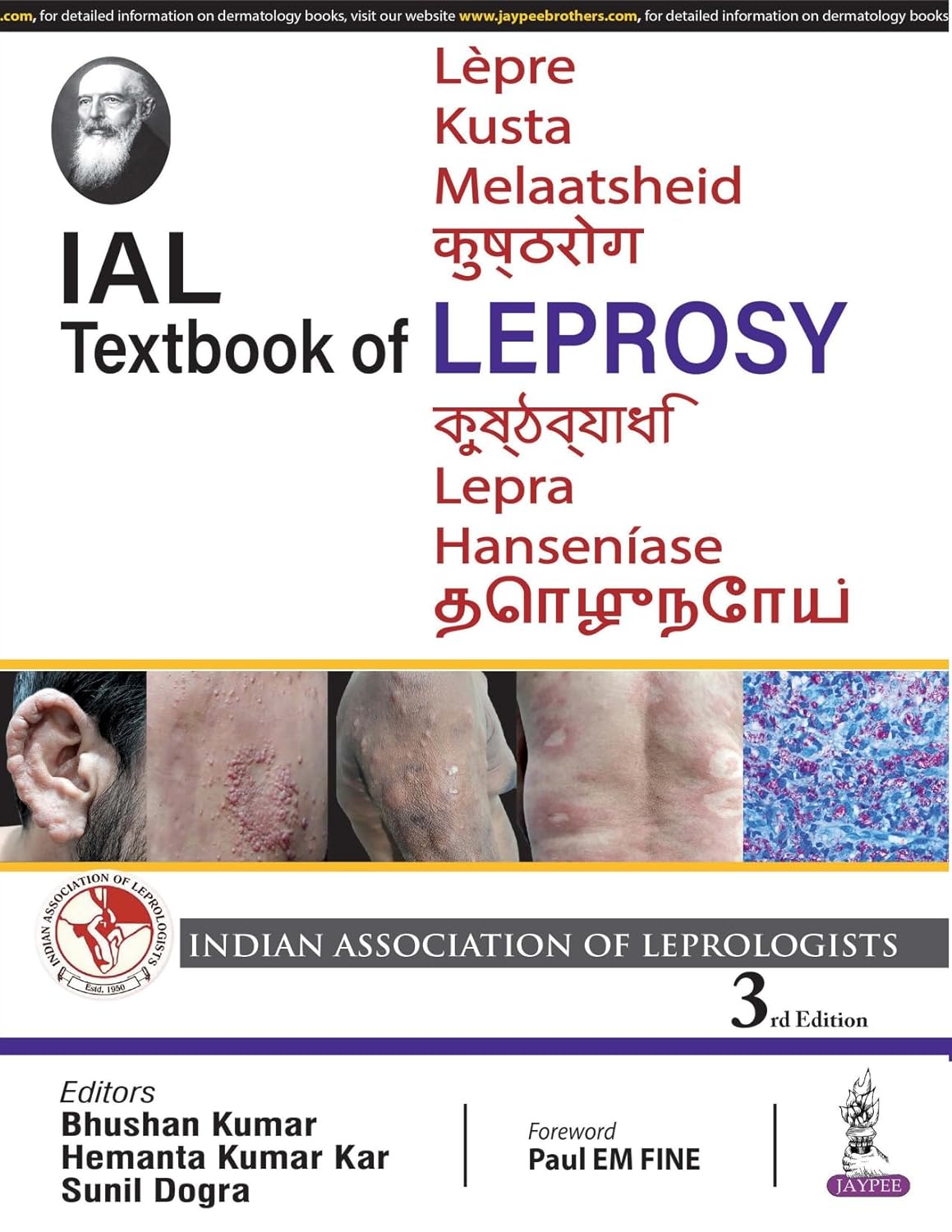 Ial Textbook of Leprosy
