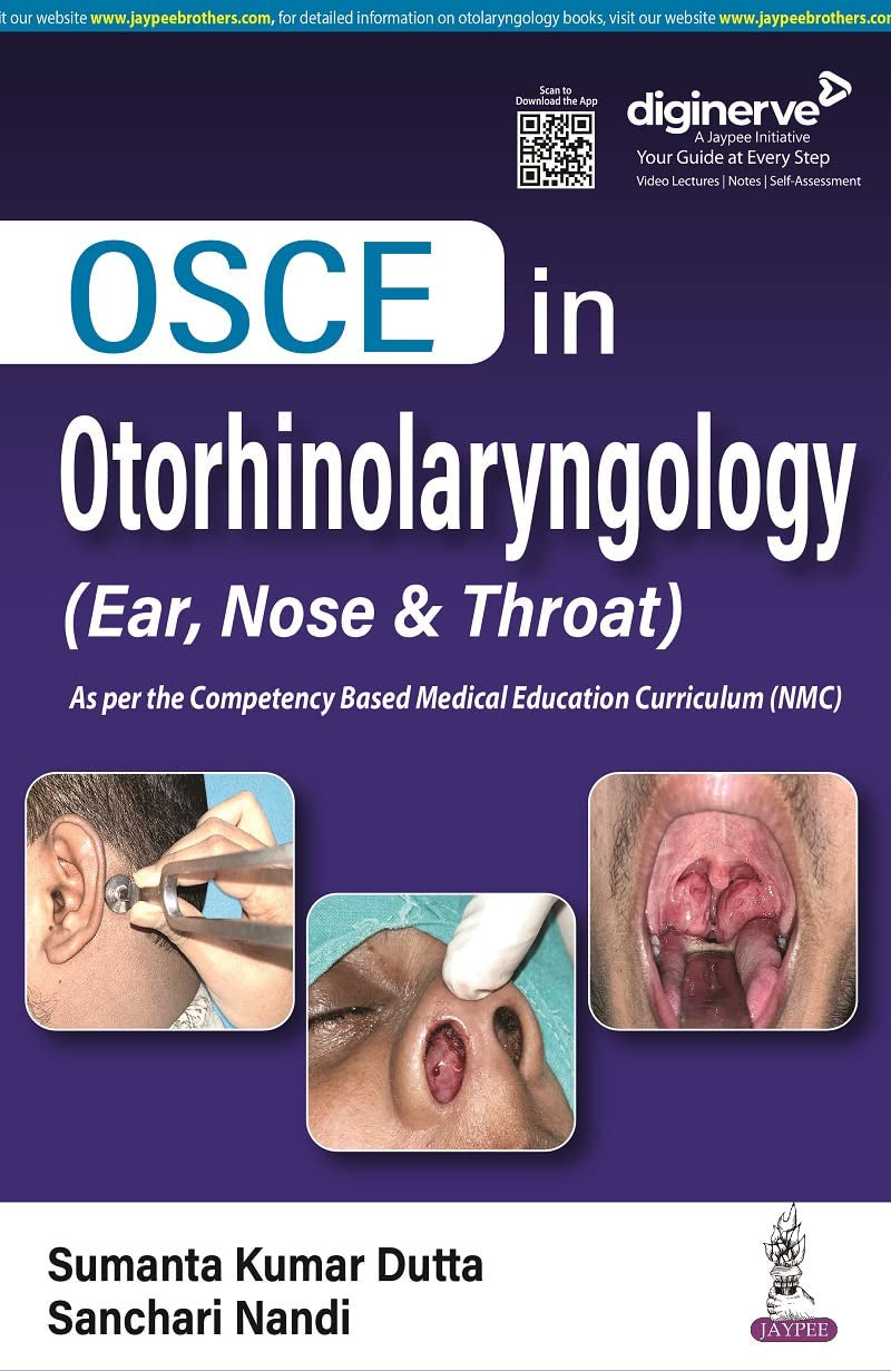 Osce in Otorhinolaryngology (Ear, Nose & Throat)
