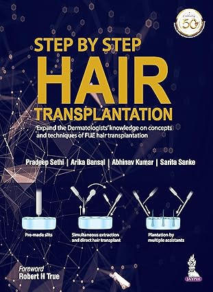 Step by Step Hair Transplantation