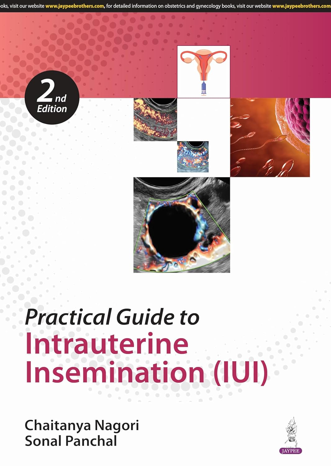 Practical Guide to Intrauterine Insemination (Iui)