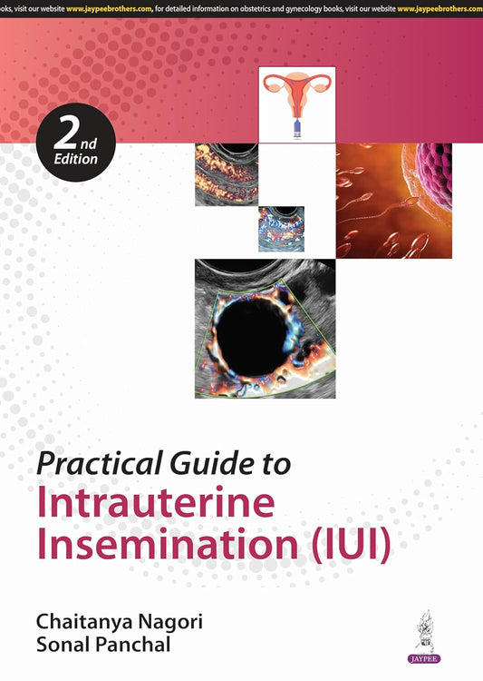 Practical Guide to Intrauterine Insemination (Iui)