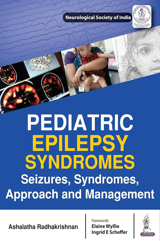 Pediatric Epilepsy Syndromes Seizures, Syndromes, Approach and Management