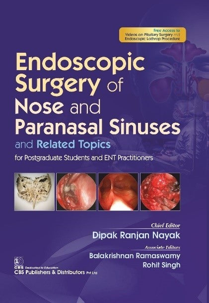 Endoscopic Surgery Of Nose And Paranasal Sinuses And Related Topics (HB)