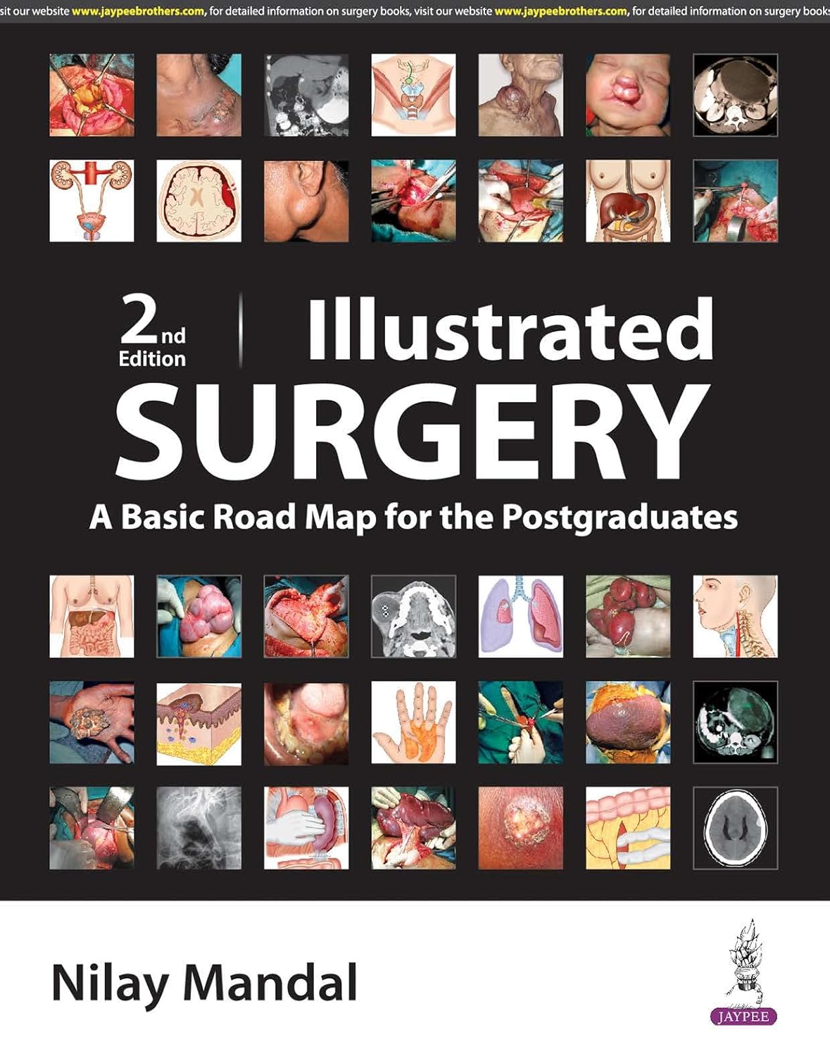 Illustrated Surgery a Basic Road Map for the Postgraduates