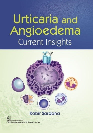 Urticaria And Angioedema Current Insights (PB)