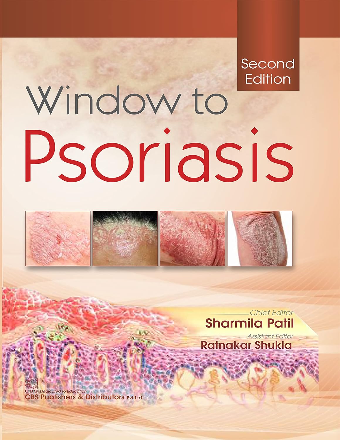 Window To Psoriasis 2e (HB)