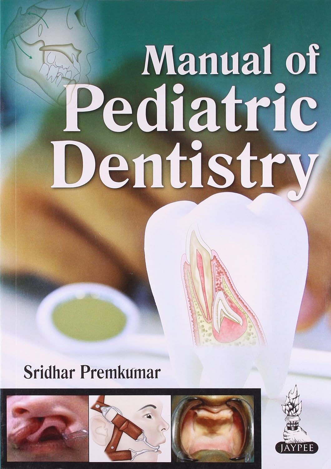 MANUAL OF PEDIATRIC DENTISTRY 1/E 2014