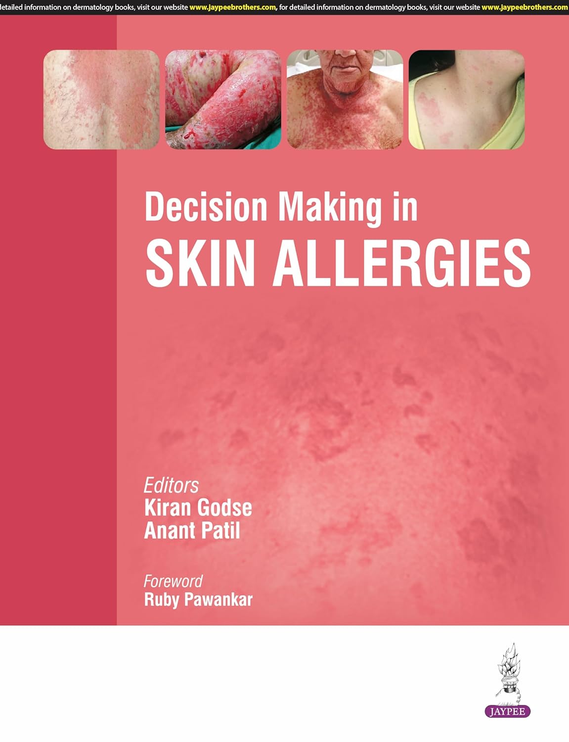 Decision Making in Skin Allergies