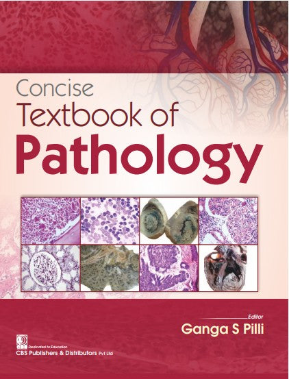 Concise Textbook of Pathology (PB)