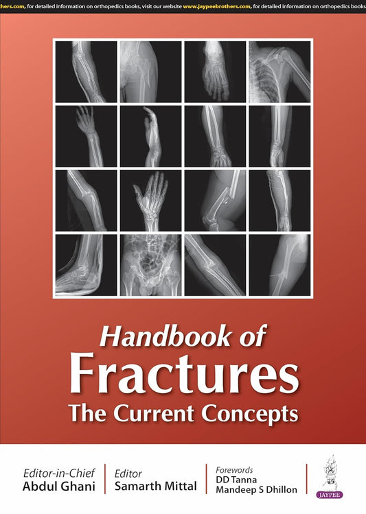 Handbook of Fractures the Current Concepts