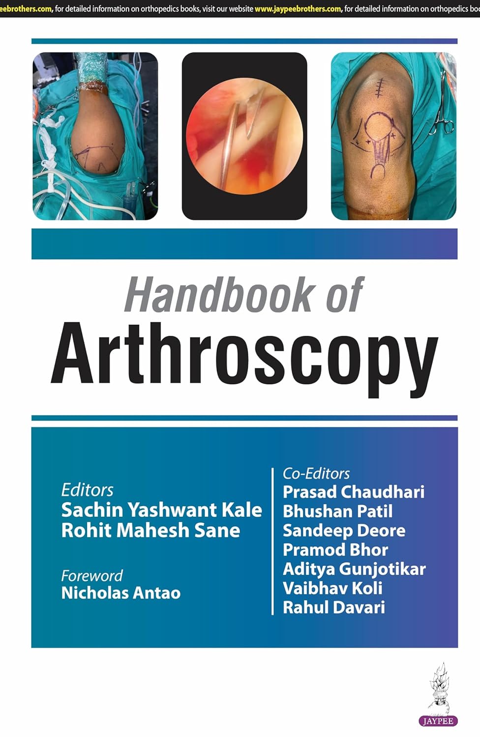 Handbook of Arthoscopy