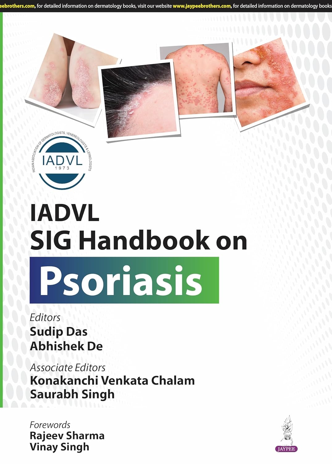 Iadvl Sig Handbook on Psoriasis
