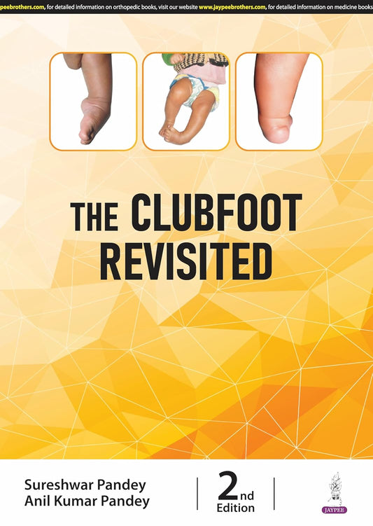 The Clubfoot Revisited
