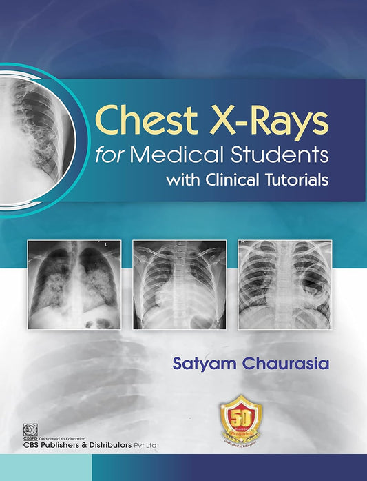 Chest X Rays For Medical Students With Clinical Tutorials (PB)