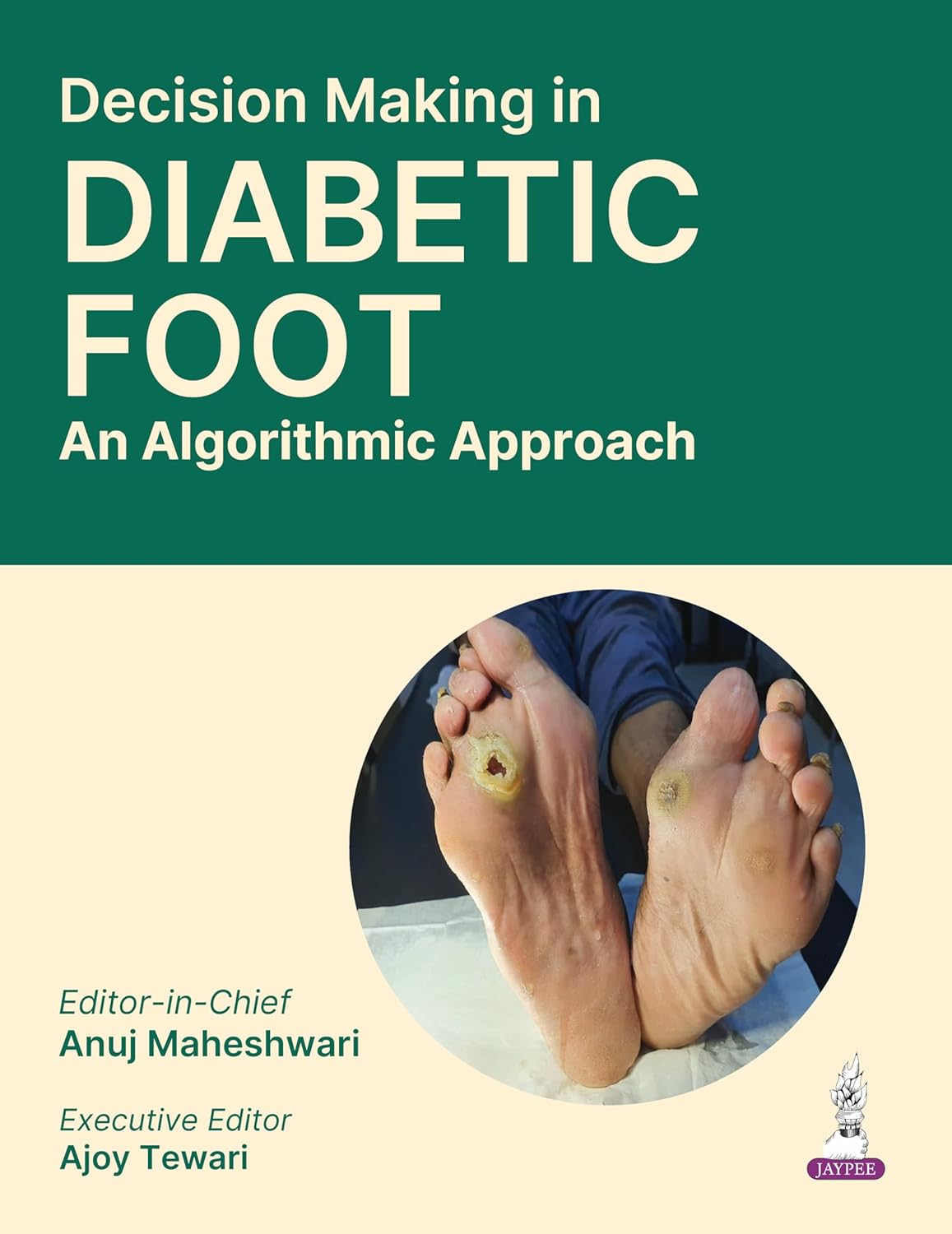 DECISION MAKING IN DIABETIC FOOT: AN ALGORITHMIC APPROACH, 1ED:2026