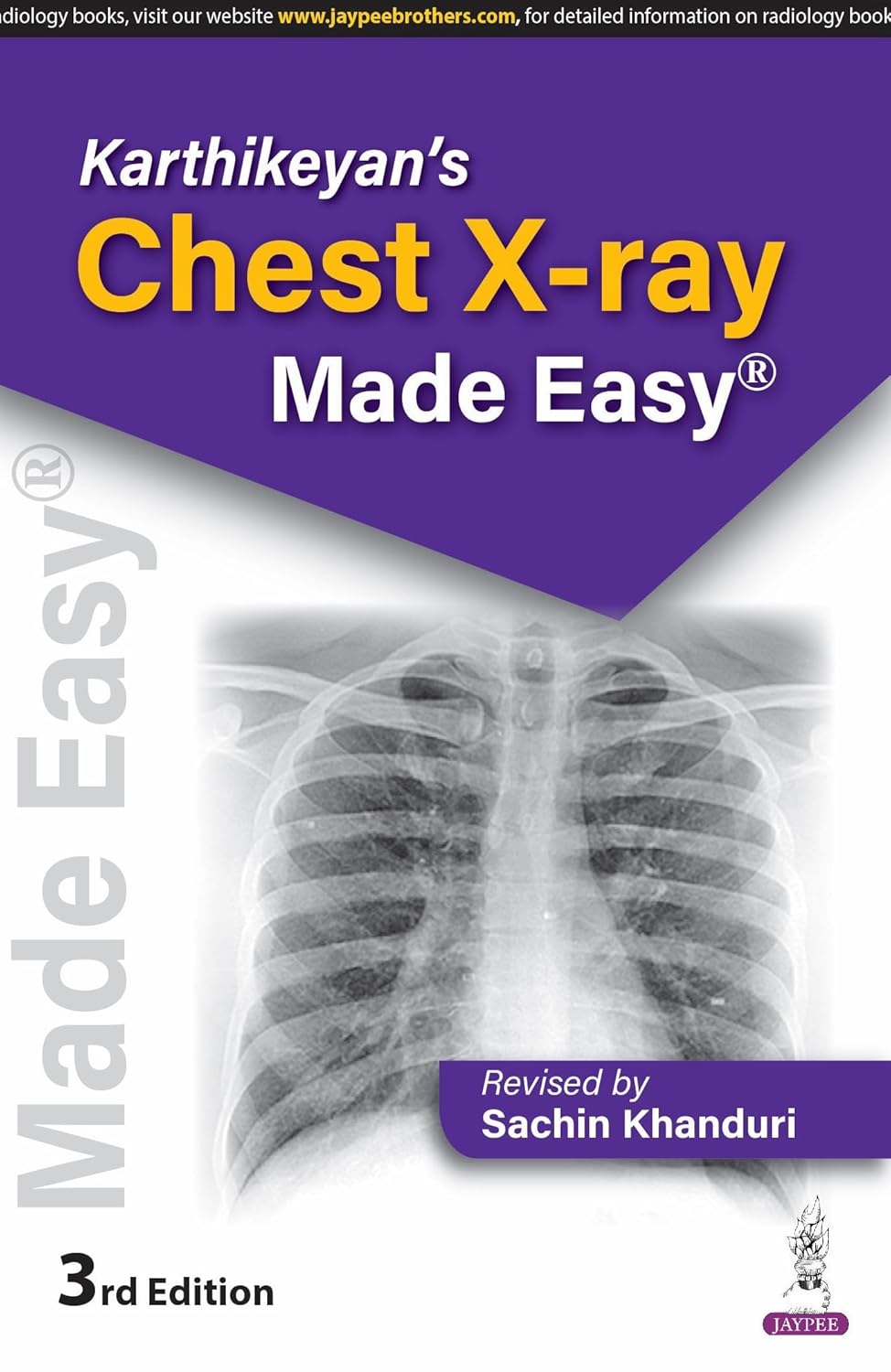 Karthikeyan'S Chest X-Ray Made Easy