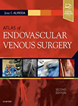 ATLAS OF ENDOVASCULAR VENOUS SURGERY 2ED (HB 2019) 