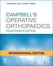 CAMPBELLS OPERATIVE ORTHOPAEDICS WITH ACCESS CODE 4 VOL SET 14ED (IE) (HB 2021)