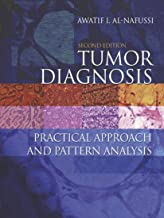 TUMOR DIAGNOSIS