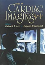 ATLAS OF CARDIAC IMAGING 